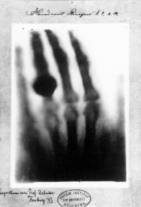 the hand of Frau Röntgen
